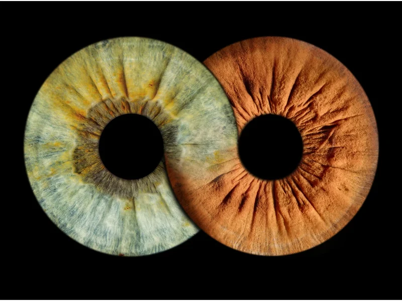 Photographe iris Fontoy - Duo Effet Infini